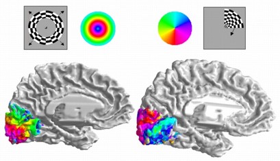 Images of fMRI response in the visual cortex to expanding and rotating chequered stimuli